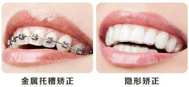 640.webp (3).png 640.webp (3).png