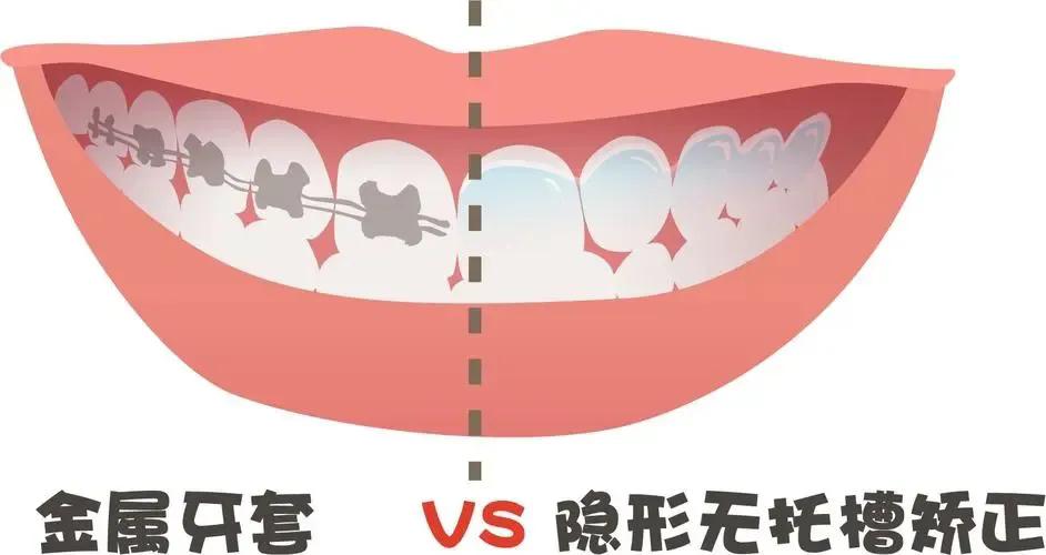 640.webp (1).png